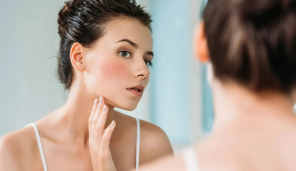 Sensitive skin: what 10 years of data on 20,000 people reveal